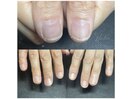 ネイルケアbefore
