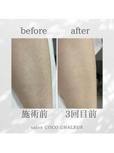 ココ シャルール(salon COCO CHALEUR)/Before　After