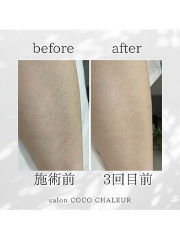 ココ シャルール(salon COCO CHALEUR)/Before　After