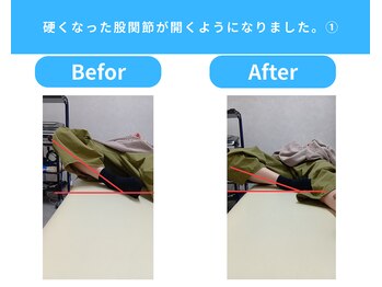 きくち整骨院/股関節が開くようになりました1