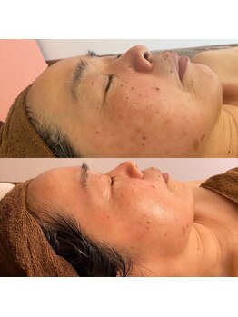 マルサンカクシカク(○△□)/