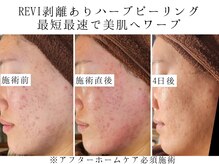 ユウビジン(YOU美人)/