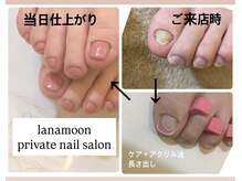 ラナムーン プティ(Lanamoon petit)/お悩み解決！綺麗に修正