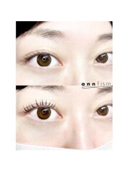 アンフィズム(annfism)/