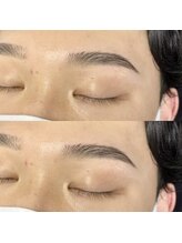 メンズ眉毛/アイブロウサロンLUMICIA.MEN 千葉店【メンズ眉毛専門店】/メンズ眉毛＆美眉アイブロウ