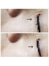 エターナル(Eternal)&nbsp;本気で 肌質改善