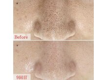 シュシュ(chou chou)/