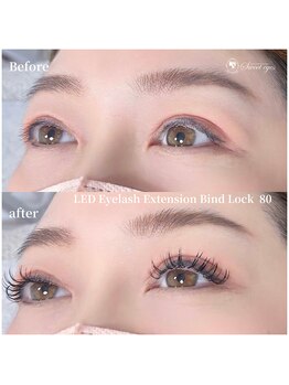スウィートアイズ(Sweet eyes)/LEDバインドロック80束