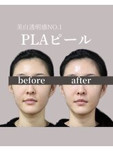 フォルディオ(FORDIO)/プラピール[札幌/円山]