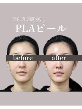 フォルディオ(FORDIO)/プラピール[札幌/円山]