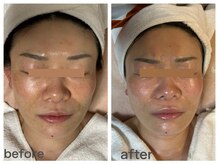 ダルセーニョ/ダルセーニヨ　ボンバーコルギ