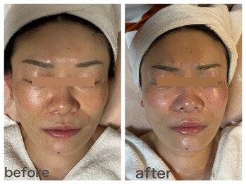 ダルセーニョ/ダルセーニヨ　ボンバーコルギ