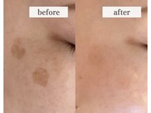 エスビューティー 三軒茶屋(S beauty)の雰囲気（本格肌管理◎こだわりの医療採用マシーンで渡韓しないで韓国美肌）