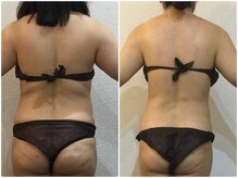 美容整体 ウェリナ 蟹江院/小顔矯正/骨盤矯正/美脚サロン