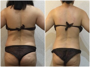 美容整体 ウェリナ 蟹江院/小顔矯正/骨盤矯正/美脚サロン