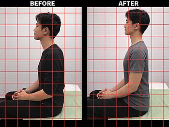 さいとう治療院 新百合ヶ丘/ストレートネック・スマホ首