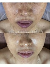 ウェリスト まこトレ整体院(WELIST)/before after