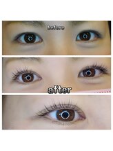 グリッターネイル(GLITTER NAILS)/セラムラッシュリフト