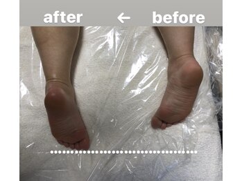 メゾン ド クロエ(Maison de Chloe)/CHLOE式パーソナル痩身