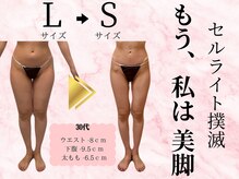 ビューティーワンド ココ(Beauty Wand COCO)