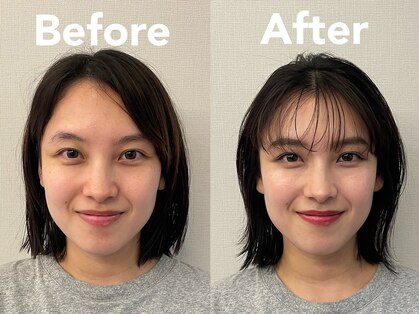 パーソナルサンフラワー(PersonalSunflower)の写真