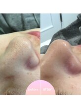 ミュー 植田店(mieux)/◆ビフォーアフター