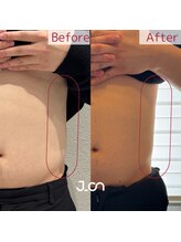 美温(mion)/レッドショット