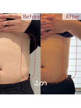 美温(mion)/レッドショット