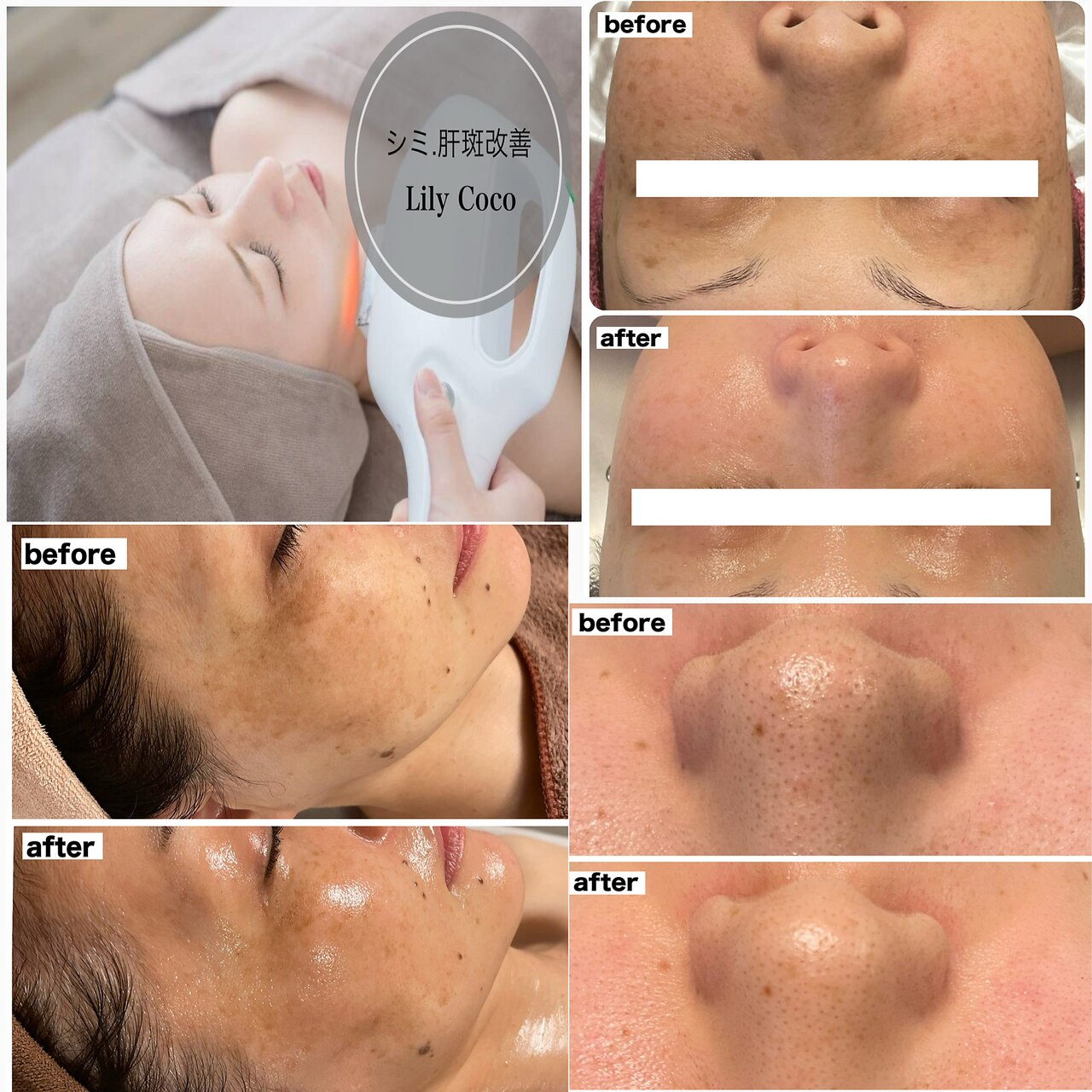 リリーココ(Lily Coco)｜ホットペッパービューティー