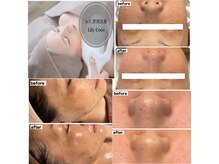 リリーココ(Lily Coco)