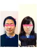 学割U24☆超ソフトタッチ小顔矯正 &nbsp;初めての方も安心な施術を心がけています