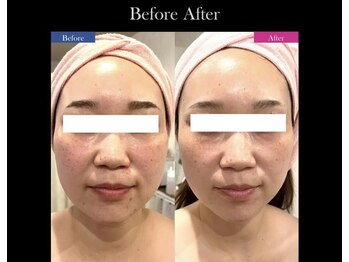 ティアレソワン(tiare soin)/巡りで肌印象改善