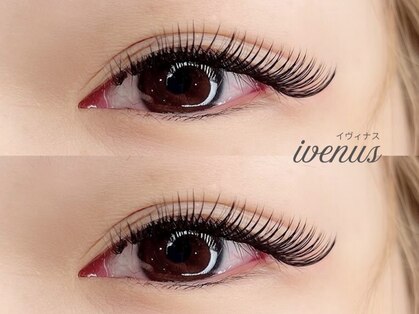 イヴィナス(ivenus)の写真