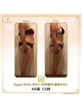 リンカ(Rinka.)/☆帯広初!!ハイパーナイフ導入☆