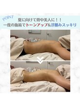 ルシェリア(Le cherien)/背中ハーブピーリング