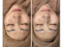 ムゥ(Mwoo)/ララピール/ララピール西宮