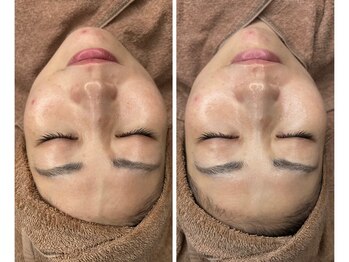 ムゥ(Mwoo)/ララピール/ララピール西宮