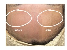 プティジョナ(Petit Jona)/お顔の産毛ケア♪