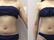 ビラ 銀座店(BILA)/キャビラジ