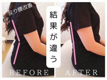 小竹向原ストレッチ整体院/反り腰の改善