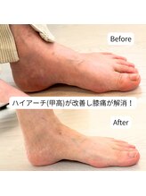 はやと整体院/７０代女性（膝痛）