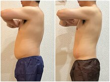 美容整体ウェリナ あま甚目寺院/小顔矯正/骨盤矯正/美脚サロン