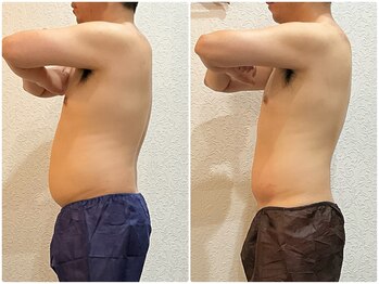 美容整体ウェリナ あま甚目寺院/小顔矯正/骨盤矯正/美脚サロン