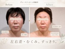 グレースフィオーレ 南越谷店(gracefiore)