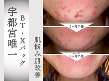 モルティー 宇都宮東店(Molti)