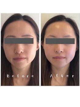 ヴィヴィアン 岡崎店(骨気&Relaxation Vivian)/最短で小顔になりたいならVivian