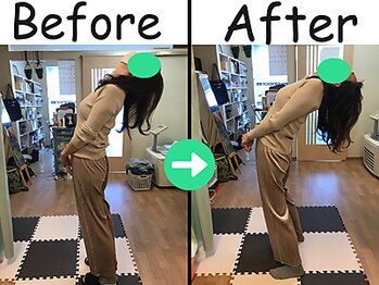 杉本接骨鍼灸院/すべりと言われ、不安だった