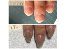 ミューネイル(mue nail)の雰囲気（3カ月で印象に変化！本気で爪改善したい方LINEよりご相談下さい）