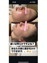 ピーアップ アヤ(P-UP AYA)/