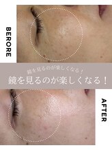 ルームエイトエイティスリー 新宿(R883)/ ガリレオピーリング